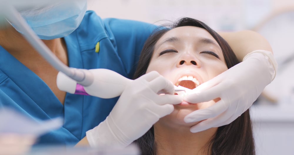 Dopo il ridimensionamento, evita queste 6 cose per mantenere i denti puliti