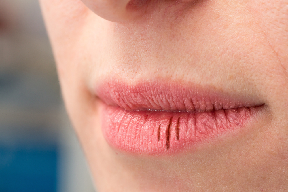 10 طرق فعالة للتغلب على مشاكل جفاف الفم