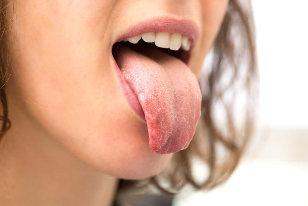 7 condizioni che causano prurito alla lingua, da problemi lievi a gravi