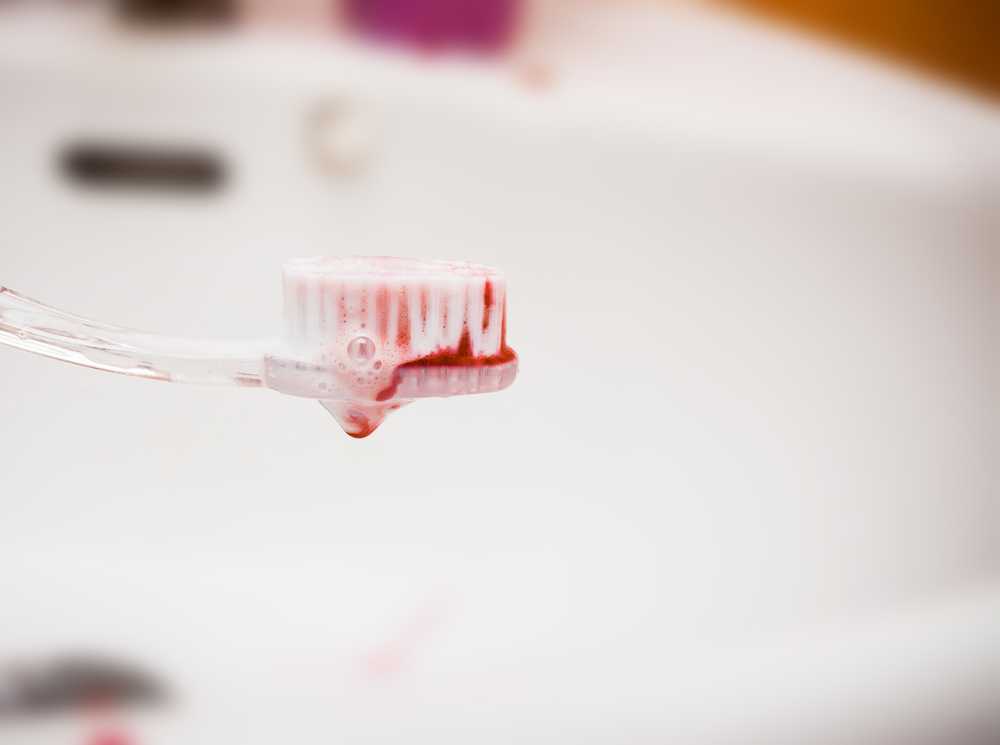 أسباب نزيف اللثة عند تنظيف أسنانك بالفرشاة