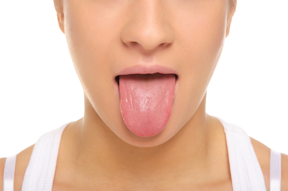 Scelta di mughetto orale naturale o infezioni fungine in bocca