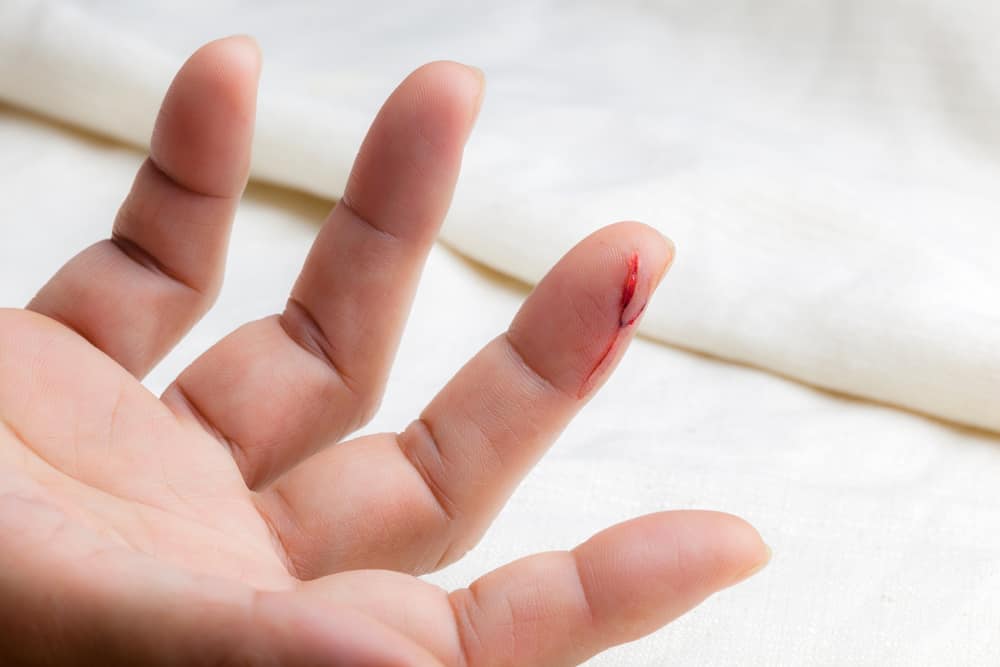Le ferite aperte dovrebbero essere fasciate per una rapida guarigione?