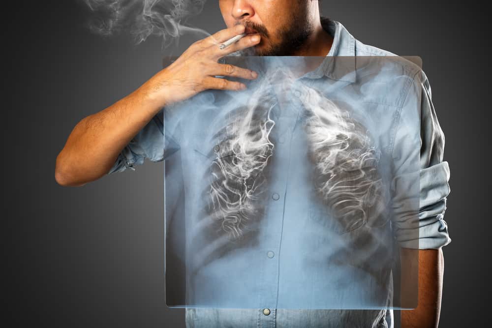 6 parti del corpo danneggiate più rapidamente a causa del fumo