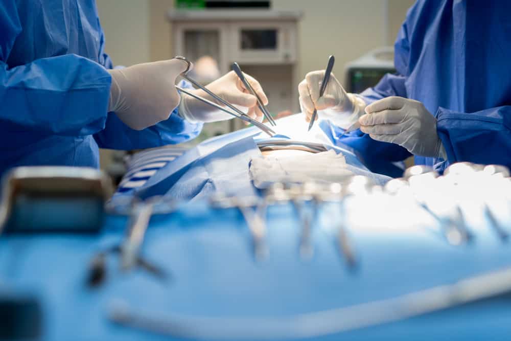 Recensioni su ovariectomia, la procedura chirurgica per rimuovere le ovaie (ovaio) nelle donne