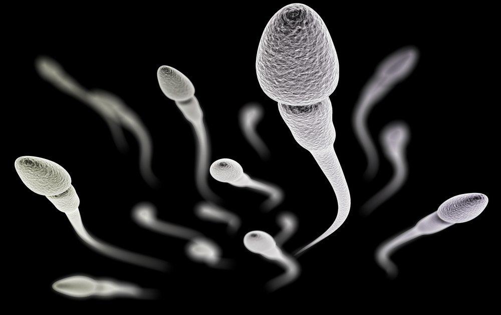 Varie anomalie dello sperma che influiscono sulla fertilità