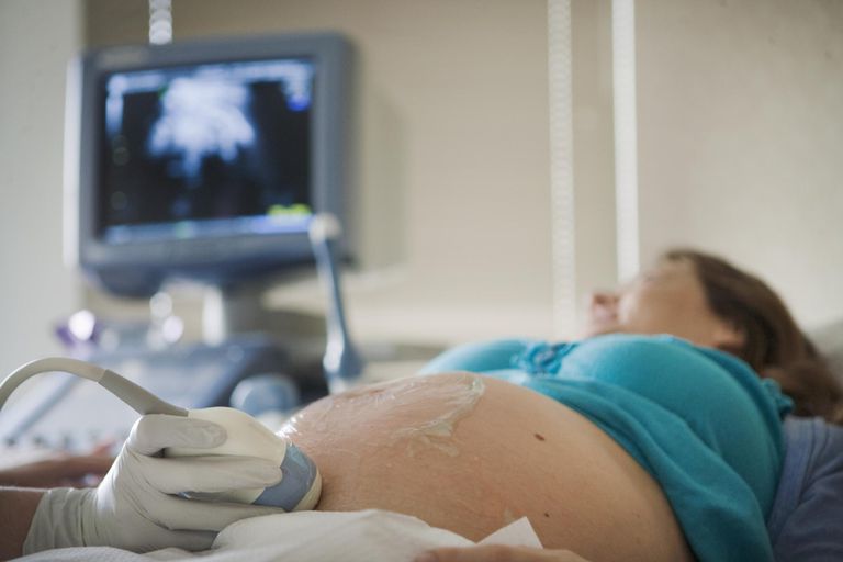 Conosci il Fetal Nonstress Test (NST), test durante la gravidanza per controllare la salute del bambino
