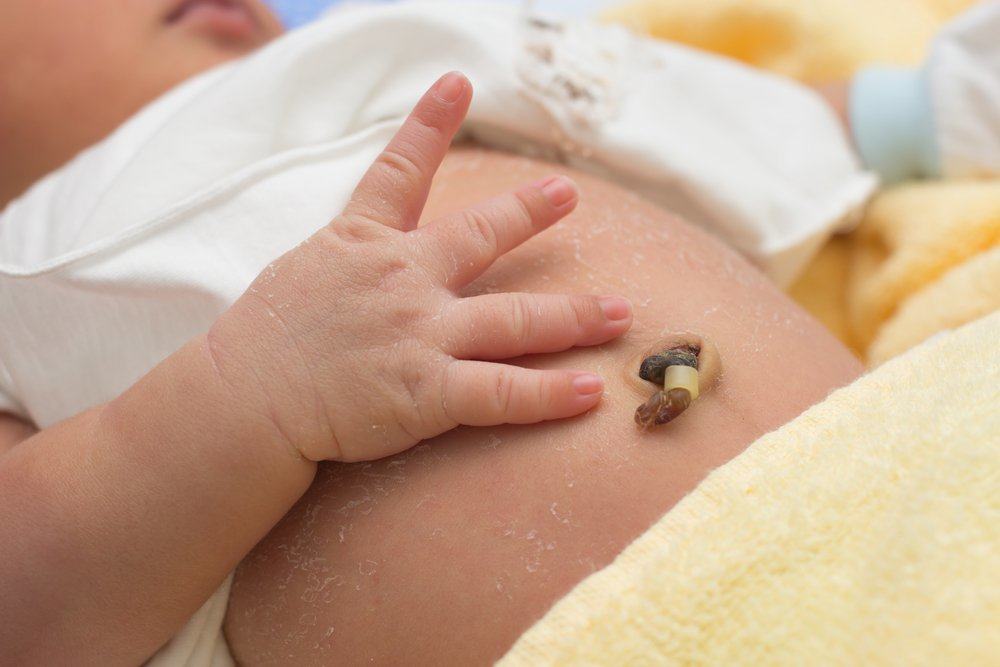 Пролапс на пъпната връв, усложнения при раждане, когато позицията на пъпната връв предхожда бебето