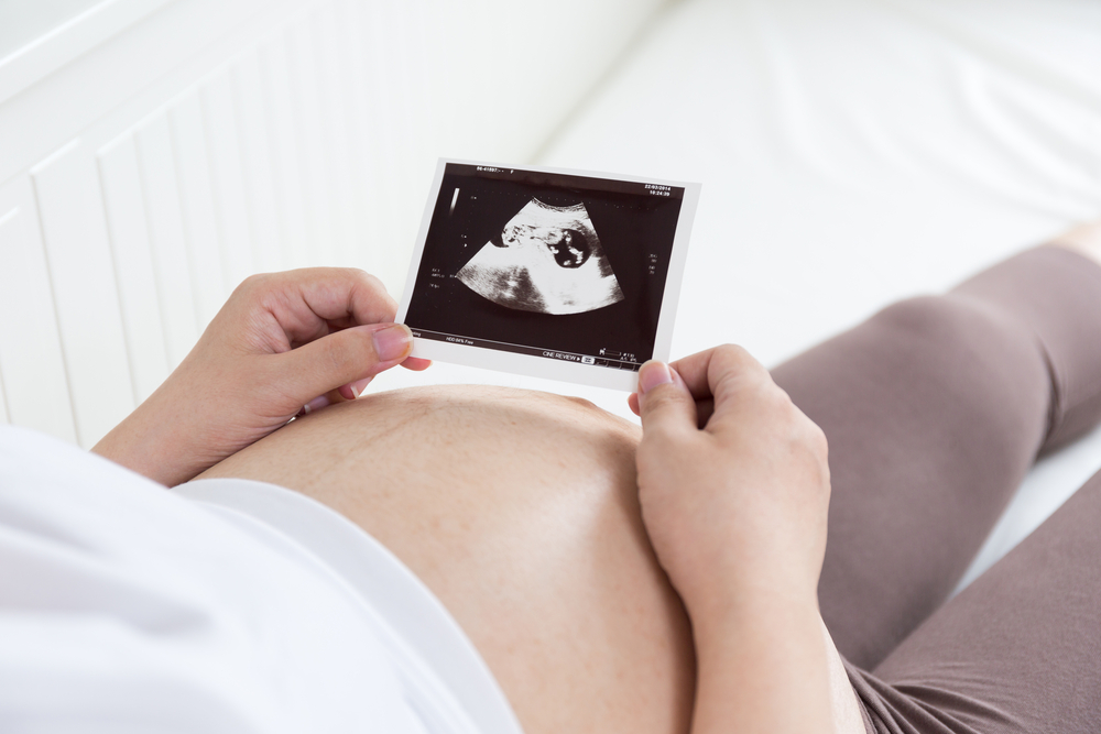 子宮内の胎児がへその緒に巻き付いている場合、正常に出産できますか？