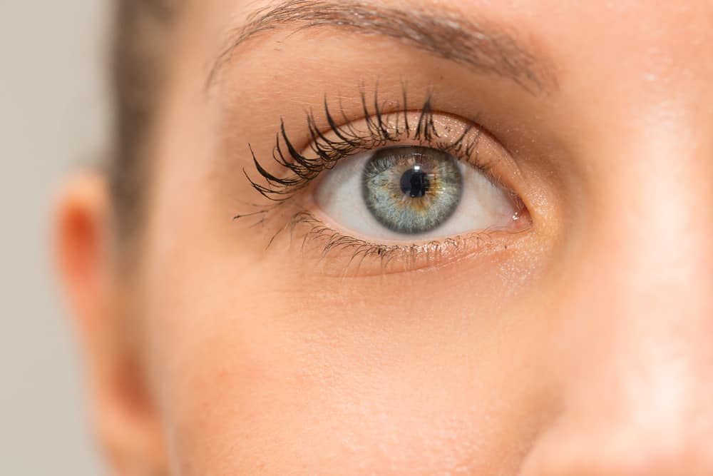 أسباب ظهور البقع البنية (النمش) في العيون بالإضافة إلى العلامات