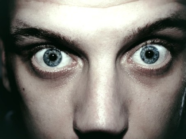 Occhi che spuntano ogni volta con gli occhi spalancati? Attenzione ai sintomi della malattia di Graves