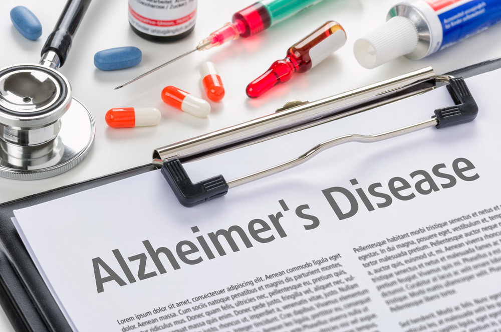 Alzheimer Hastalığını Tedavi Etmek İçin İlaçları ve Tedavileri Bilin