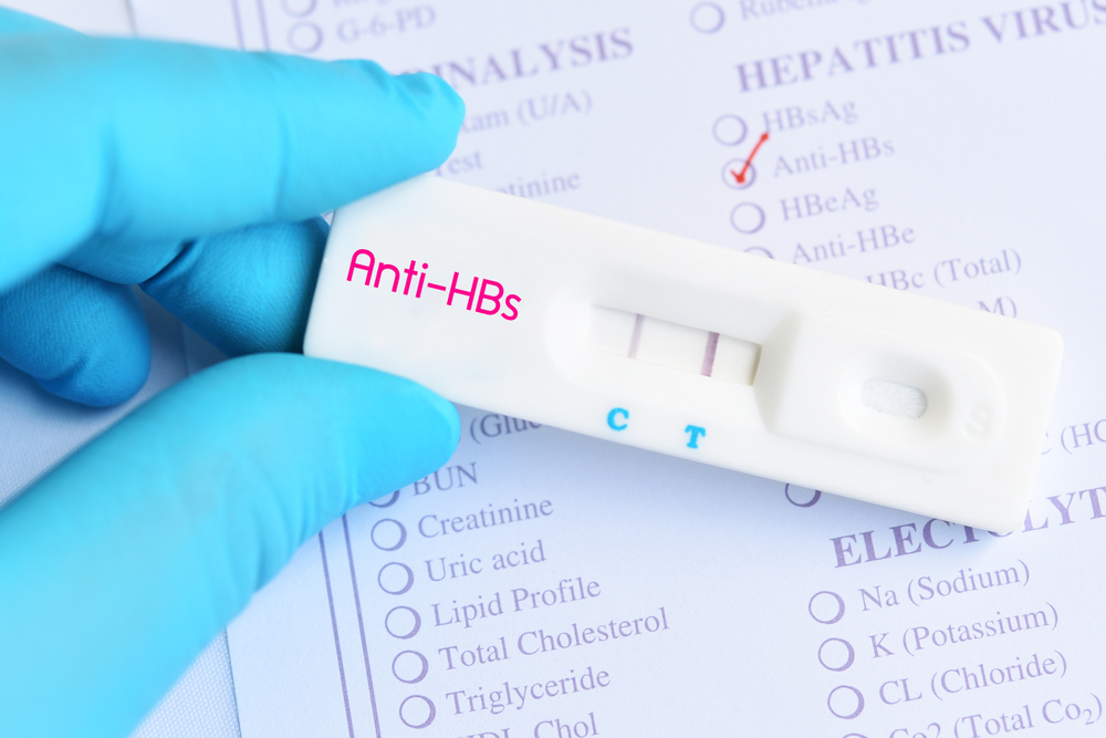 Conoscere gli anti HB, altre opzioni di test per la diagnosi di epatite B