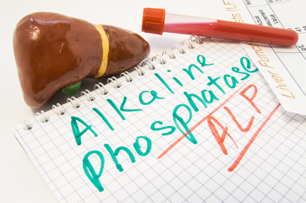 Cosa significa se i livelli di fosfatasi alcalina sono alti dopo un esame del sangue?