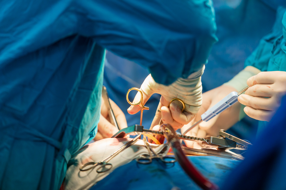 زرع الرئة ، إجراء جراحي لاستبدال أعضاء الرئة