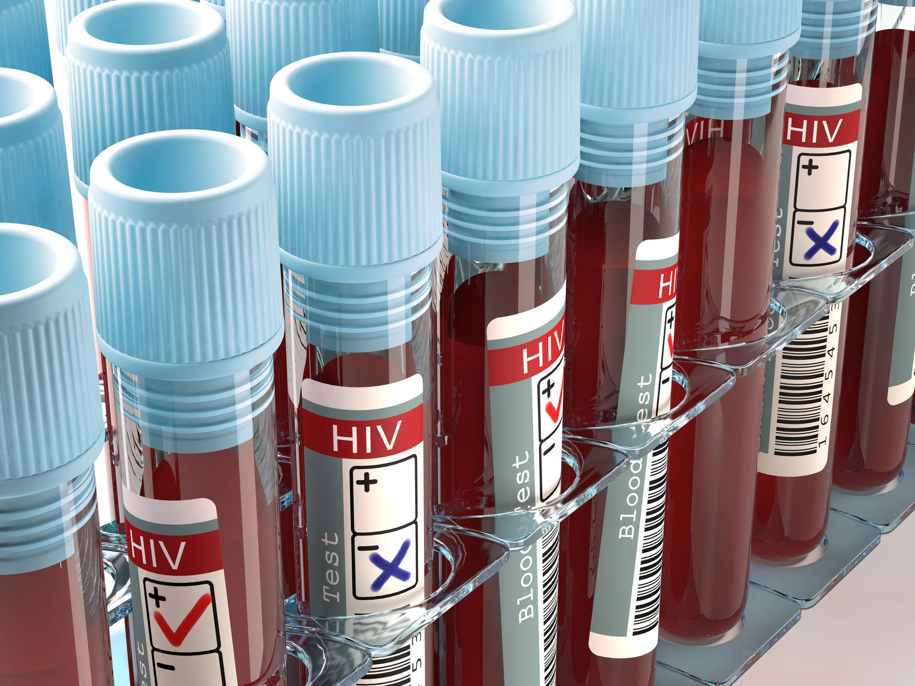 هل أنا معرض لخطر الإصابة بفيروس نقص المناعة البشرية؟ احذر من الأسباب المختلفة لفيروس نقص المناعة البشرية / الإيدز