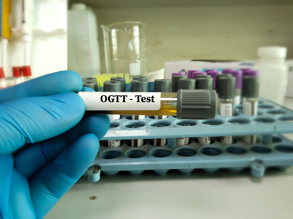 اختبار تحمل الجلوكوز الفموي (OGTT) لتشخيص مرض السكري